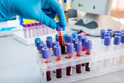 provette sangue