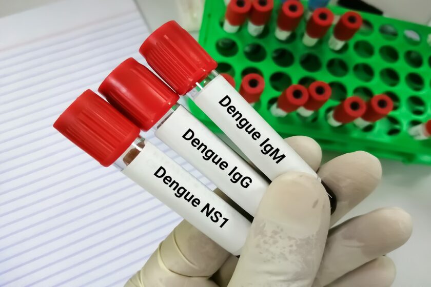 Virus Dengue