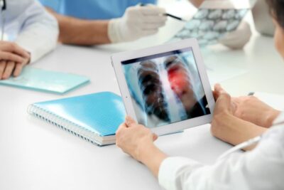 screening-tumore-polmone-1-min