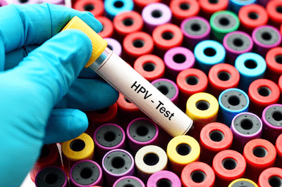 hpv pap test